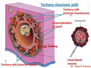 Dr. Sherif Fahmy
Fetal blood
vessels
Tertiary velli
(chorion frondosum)
Tertiary velli (chorion leave)
Cytotrophoblas
tic shell
Tertiary chorionic velli
Dr. Sherif Fahmy
 