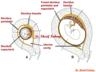 Dr. Sherif Fahmy
Decidua basalis
Decidua
parietalis
Decidua
capsularis
Uterine
cavity
Fused decidua
parietalis and
capsularis
Decidua
basalis
Dr. Sherif Fahmy
 