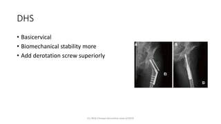 Dhs Radiopaedia Decision making in fractures around hip icl 2019 chit | PPTX