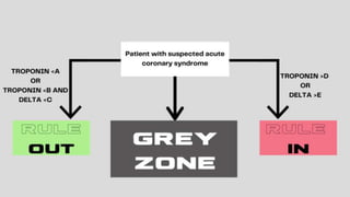 Decisions in the Grey Zone EUSEM 2020