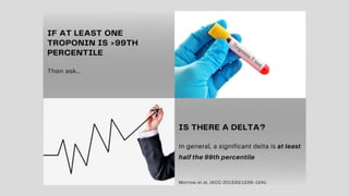 Decisions in the Grey Zone EUSEM 2020