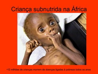 Criança subnutrida na África 12 milhões de crianças morrem de doenças ligadas à pobreza todos os anos  