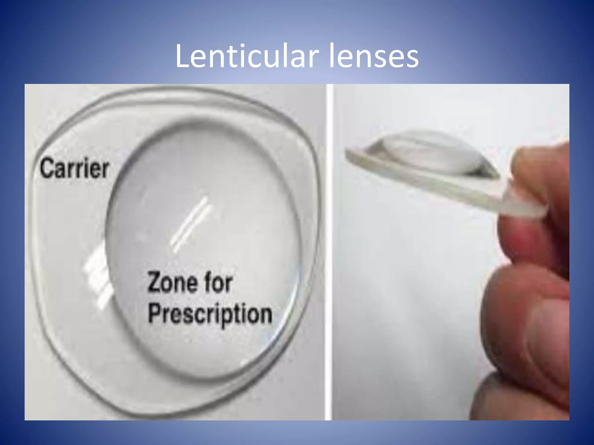 Lenticular lenses
 