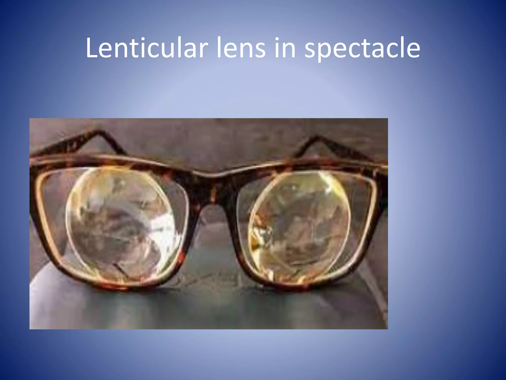 Lenticular lens in spectacle
 