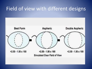 Decoding the lenses | PPTX