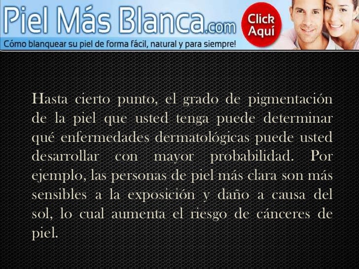 Que ayuda contra las pecas