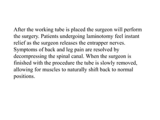 After the working tube is placed the surgeon will perform
the surgery. Patients undergoing laminotomy feel instant
relief as the surgeon releases the entrapper nerves.
Symptoms of back and leg pain are resolved by
decompressing the spinal canal. When the surgeon is
finished with the procedure the tube is slowly removed,
allowing for muscles to naturally shift back to normal
positions.
 
