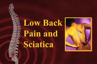 Low Back
Pain and
Sciatica

 