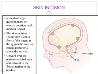 Old Reverse Question Mark Incision Decompressive craniectomy | PPTX