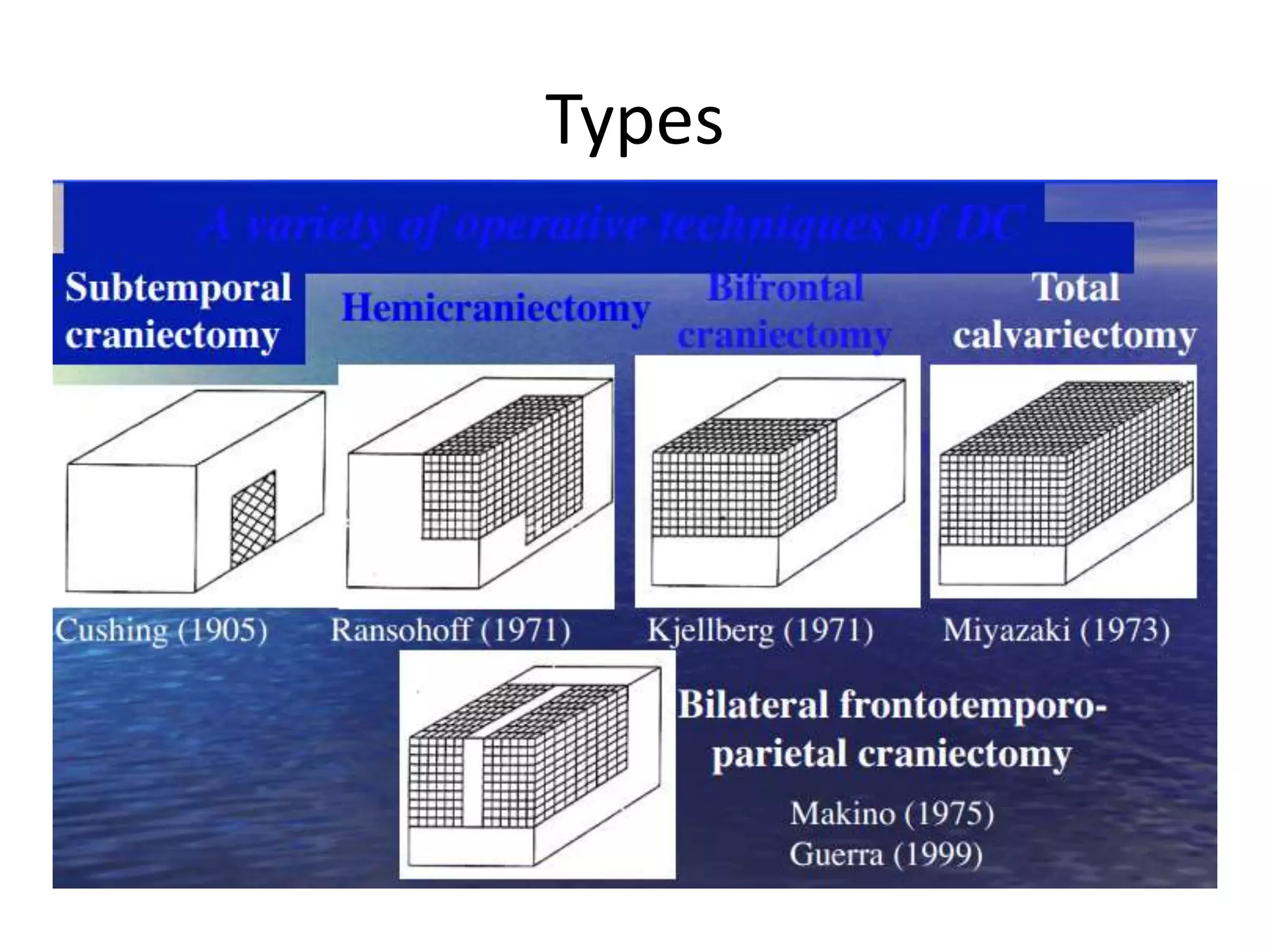 Decompressive craniectomy in Traumatic Brain Injury | PPSX
