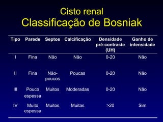 Cisto renal Classificação de Bosniak Sim >20 Muitas Muitos Muito espessa IV Não 0-20 Moderadas Muitos Pouco espessa III Não 0-20 Poucas Não-poucos Fina II Não 0-20 Não Não Fina I Ganho de intensidade Densidade pré-contraste (UH) Calcificação Septos Parede Tipo 