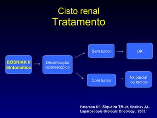 Cisto renal Tratamento BOSNIAK II Sintomático Decorticação laparoscópica OK Nx parcial ou radical Sem tumor Com tumor Paterson RF,  Siqueira TM Jr , Shalhav AL.  La paroscopic Urologic Oncology,  2003.   