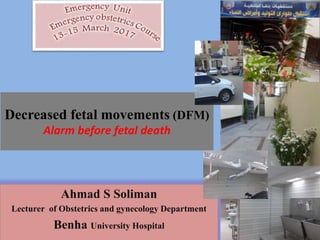 Decreased fetal movements (DFM)
Alarm before fetal death
Ahmad S Soliman
Lecturer of Obstetrics and gynecology Department
Benha University Hospital
 