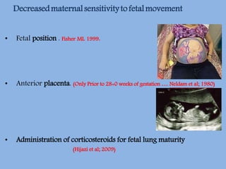• Fetal position . Fisher ML 1999.
• Anterior placenta. (Only Prior to 28+0 weeks of gestation …. Neldam et al; 1980)
• Administration of corticosteroids for fetal lung maturity
(Hijazi et al; 2009)
Decreasedmaternalsensitivitytofetalmovement
 