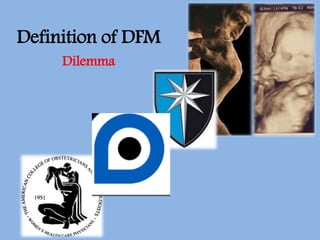 Definition of DFM
Dilemma
 