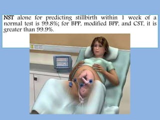 NST alone for predicting stillbirth within 1 week of a
normal test is 99.8%; for BPP, modified BPP, and CST, it is
greater than 99.9%.
 