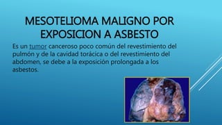 MESOTELIOMA MALIGNO POR
EXPOSICION A ASBESTO
Es un tumor canceroso poco común del revestimiento del
pulmón y de la cavidad torácica o del revestimiento del
abdomen, se debe a la exposición prolongada a los
asbestos.
 
