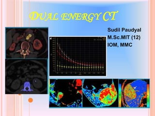DUAL ENERGY CT
Sudil Paudyal
M.Sc.MIT (12)
IOM, MMC
1
 