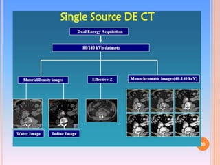 Dual Energy CT | PPTX