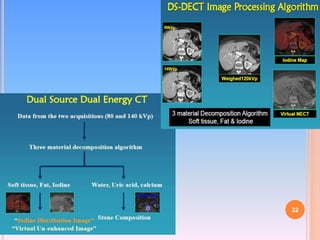 Dual Energy CT | PPTX