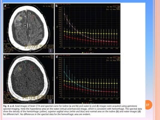 Dual Energy CT | PPTX