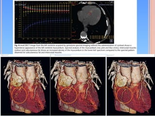 Dual Energy CT | PPTX