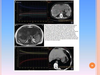 Dual Energy CT | PPTX