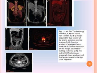 Dual Energy CT | PPTX