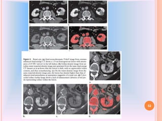 Dual Energy CT | PPTX