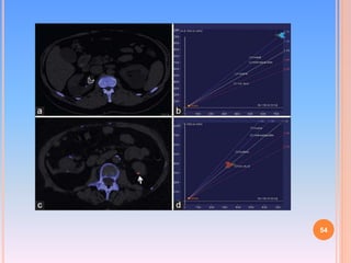 Dual Energy CT | PPTX