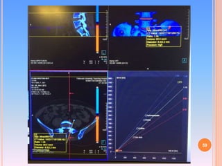 Dual Energy CT | PPTX