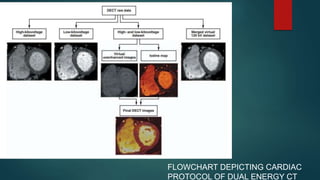 APPLICATION OF DUAL ENERGY CT IN EMERGENCY RADIOLOGY | PPTX