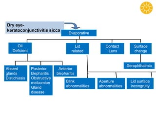 Dry eye-
keratoconjunctivitis sicca
Evaporative
Oil
Deficient
Lid
related
Contact
Lens
Surface
change
Absent
glands
Distichiasis
Posterior
blepharitis
Obstructive
meibomion
Gland
disease
Anterior
blepharitis
Blink
abnormalities
Lid surface
incongruity
Aperture
abnormalities
Xerophthalmia
 