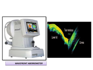 WAVEFRONT ABERROMETER
 