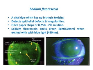 • A vital dye which has no intrinsic toxicity.
• Detects epithelial defects & irregularities.
• Filter paper strips or 0.25% - 2% solution.
• Sodium fluorescein emits green light(520nm) when
excited with with blue light (490nm).
Sodium fluorescein
 