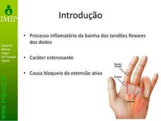 Introdução
• Processo inflamatório da bainha dos tendões flexores
dos dedos
• Caráter estenosante
• Causa bloqueio da extensão ativa
 