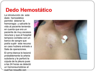 Dedo Hemostático
La introducción de este
dedo hemostático
permitió detener la
hemorragia y salvarle la
vida al paciente teniendo
en cuenta que era un
paciente de muy escasos
recursos y que el hospital
tampoco contaba con un
banco de sangre que
podía suplir este recurso
en caso hubiera entrado a
Sala de operaciones.
El arma blanca le lesionó
probablemente la arteria
subclavia y le perforó la
cúpula de la pleura pues
a las 24 horas se detectó
un hemoneumotórax el
cual fue resuelto con

 