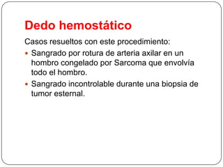Dedo hemostático
Casos resueltos con este procedimiento:
 Sangrado por rotura de arteria axilar en un
hombro congelado por Sarcoma que envolvía
todo el hombro.
 Sangrado incontrolable durante una biopsia de
tumor esternal.

 