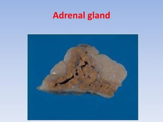 Adrenal gland
 