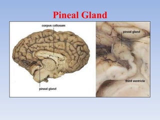 Pineal Gland
 
