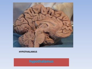 HYPOTHALAMUS
hypothalamus
 