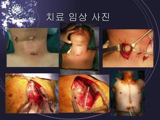 치료 임상 사진 