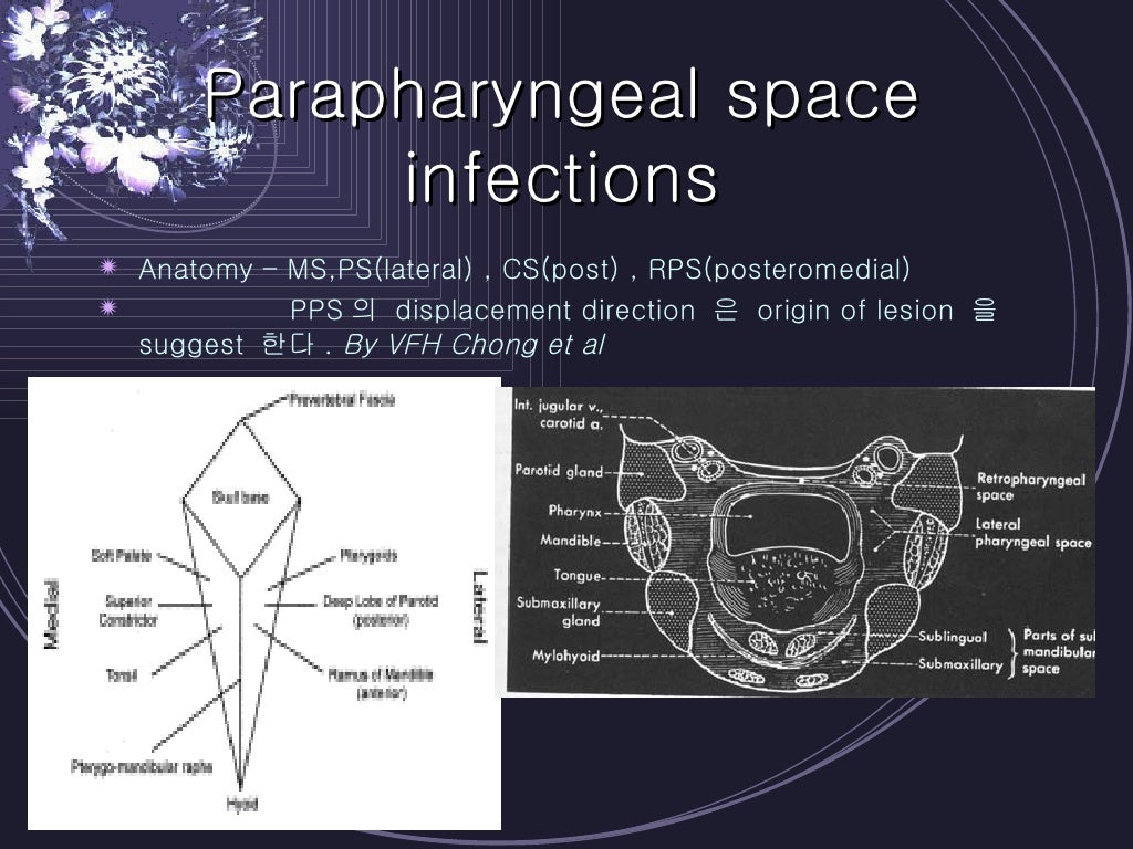 Deep Neck Infections
