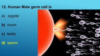 12. Human Male germ cell is
a) zygote
b) ovum
c) testis
d) sperm
 