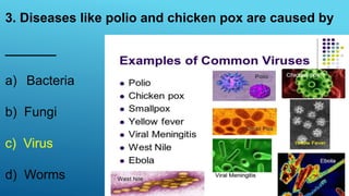 3. Diseases like polio and chicken pox are caused by
_______
a) Bacteria
b) Fungi
c) Virus
d) Worms
 