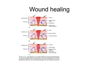 Wound healing and management of wound in surgery | PPT