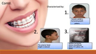 Characterised by:
1.
2. 3.
Contd.
 