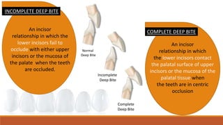 An incisor
relationship in which the
lower incisors fail to
occlude with either upper
incisors or the mucosa of
the palate when the teeth
are occluded.
An incisor
relationship in which
the lower incisors contact
the palatal surface of upper
incisors or the mucosa of the
palatal tissue when
the teeth are in centric
occlusion
INCOMPLETE DEEP BITE
COMPLETE DEEP BITE
Normal
Deep Bite
Incomplete
Deep Bite
Complete
Deep Bite
 