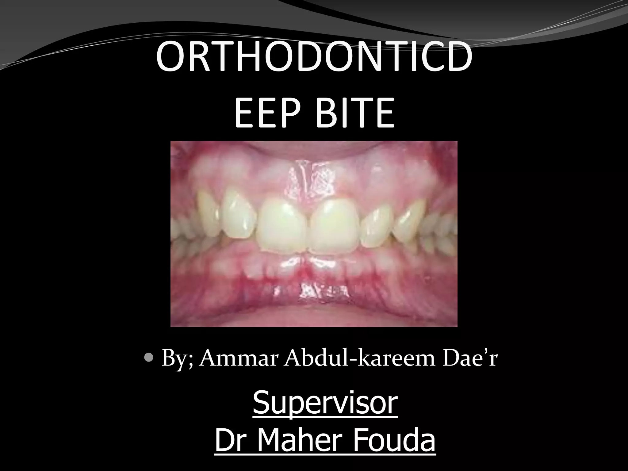 orthodontic deep bite PPT
