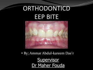 ORTHODONTICD
EEP BITE
 By; Ammar Abdul-kareem Dae’r
Supervisor
Dr Maher Fouda
 